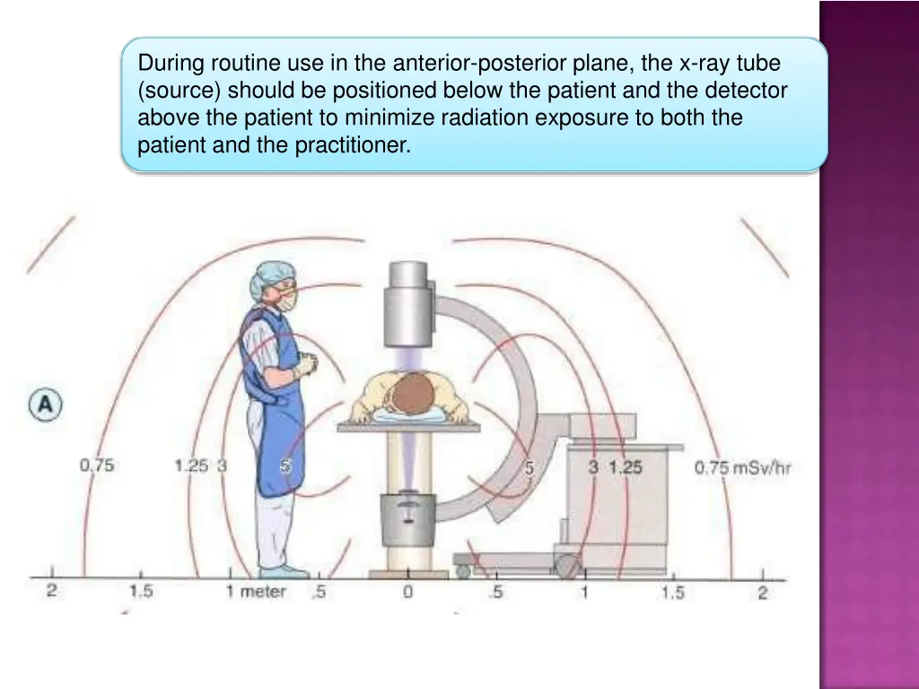 during routine use in the anterior posterior