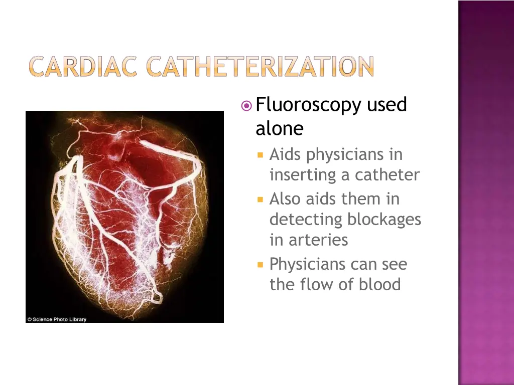 fluoroscopy used alone aids physicians