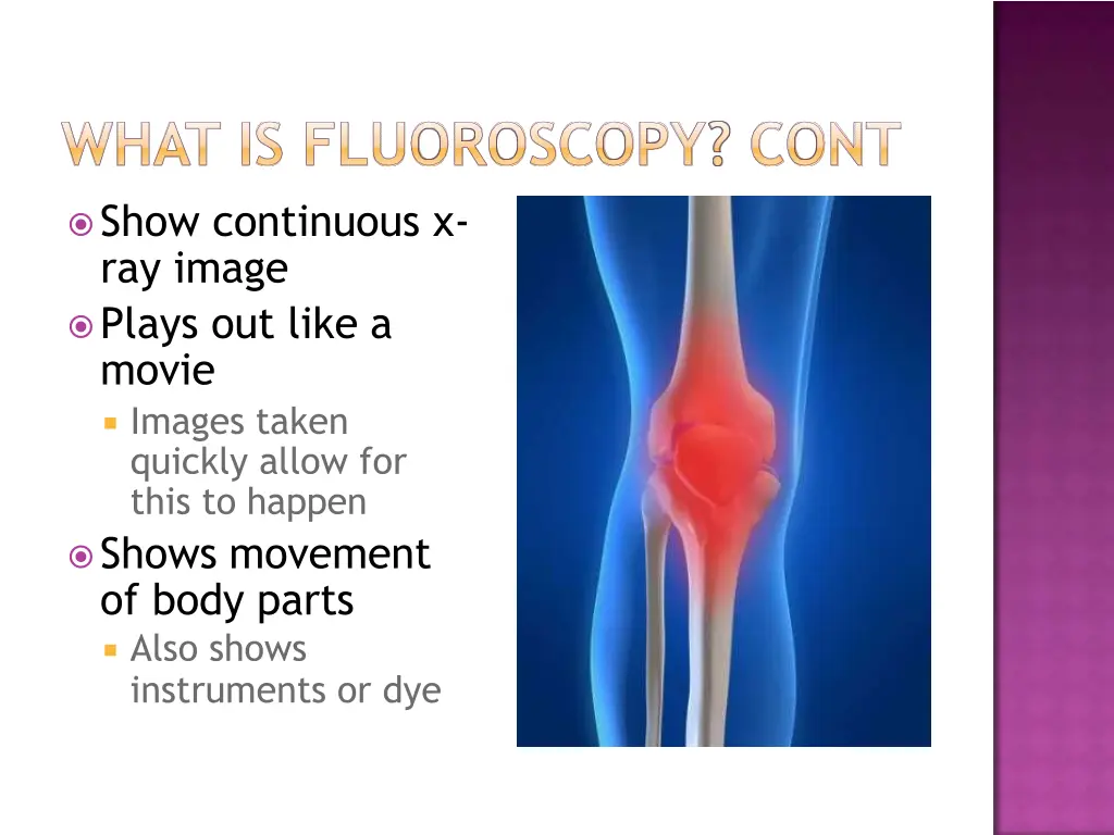 show continuous x ray image plays out like