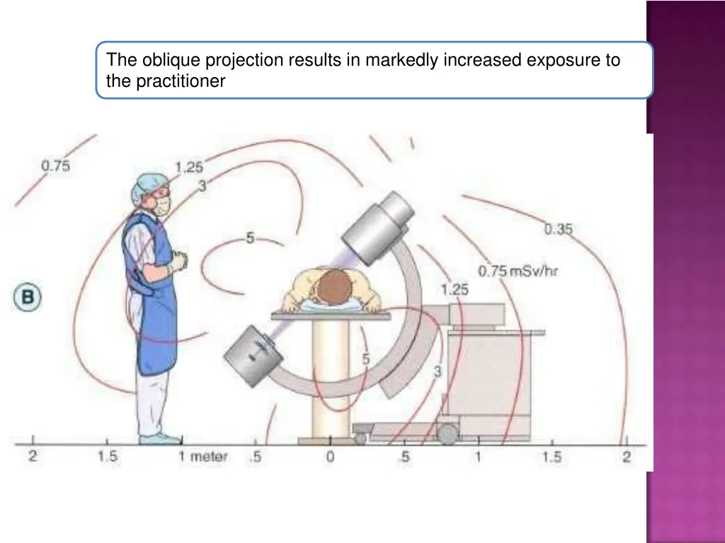 the oblique projection results in markedly