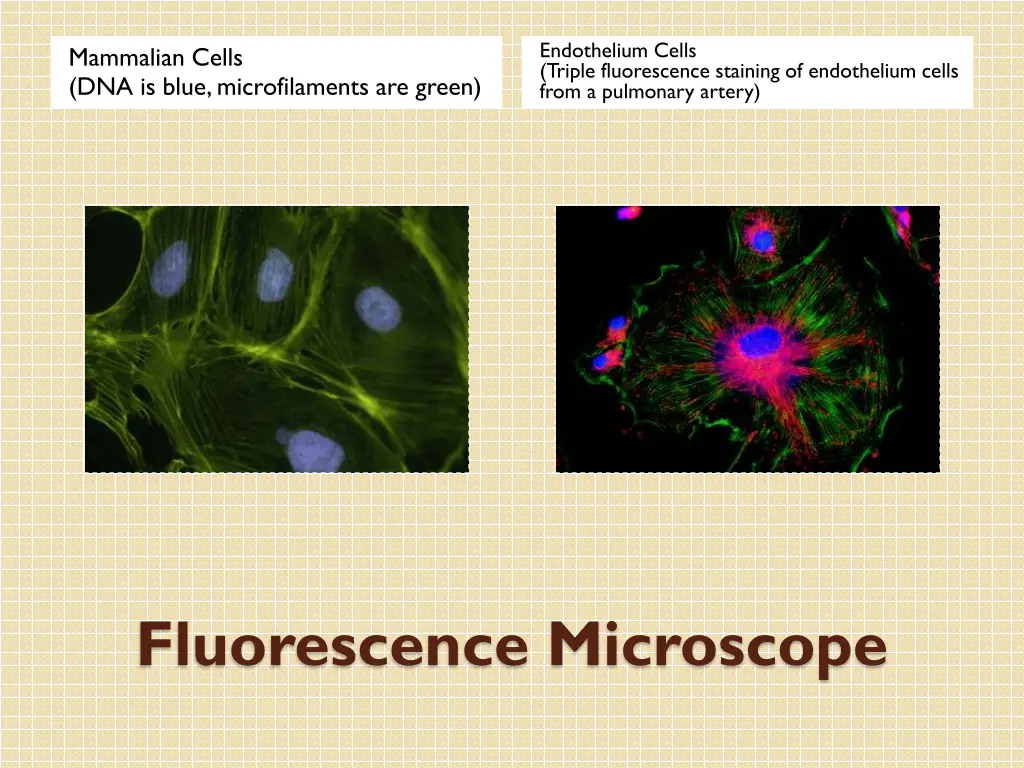 endothelium cells triple fluorescence staining