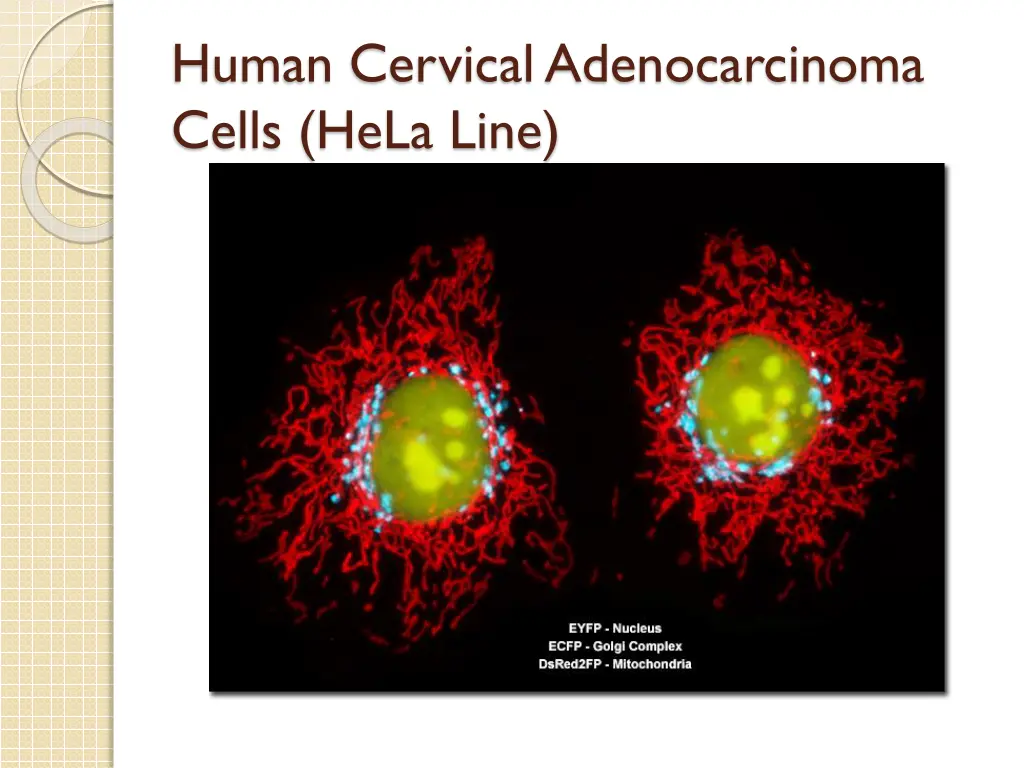 human cervical adenocarcinoma cells hela line