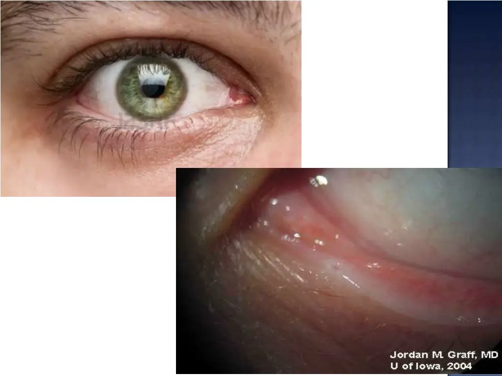 slide16