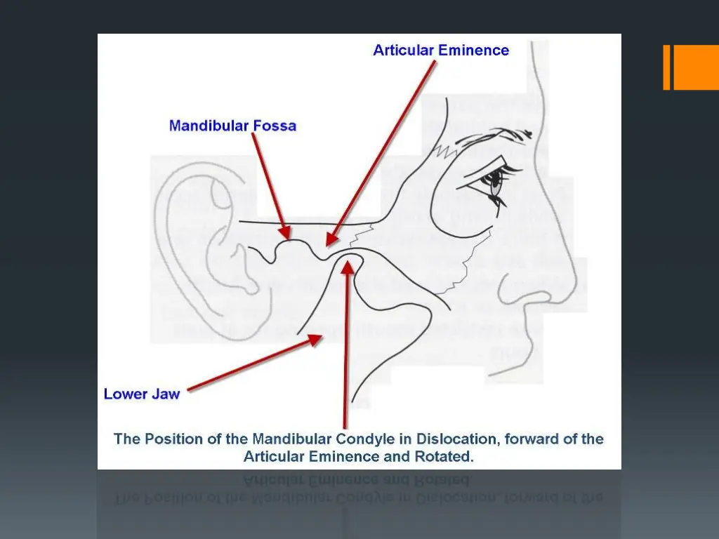 slide19