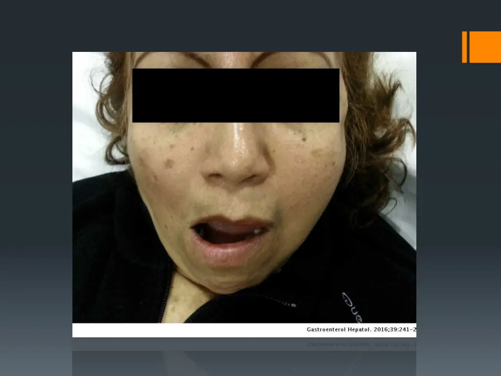 slide20