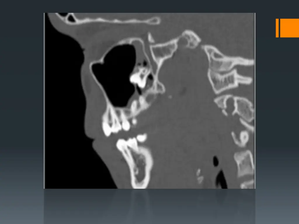 slide23