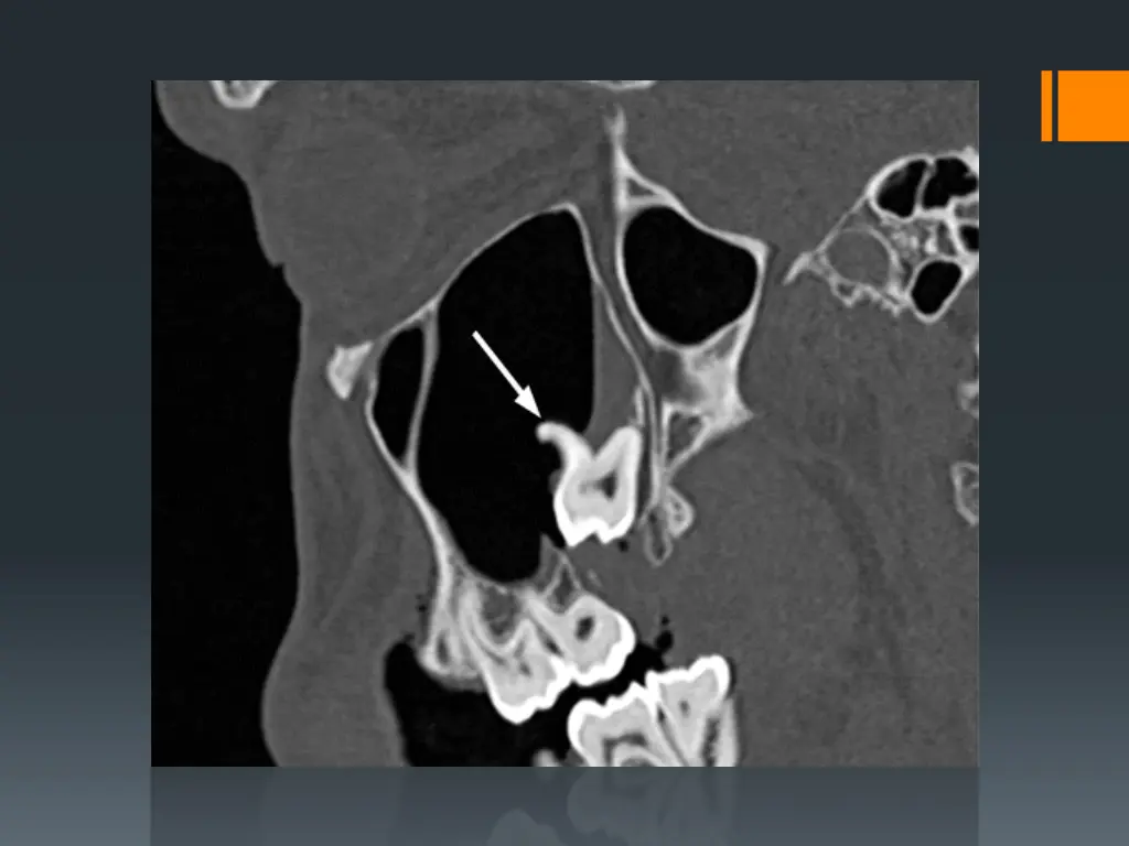 slide25