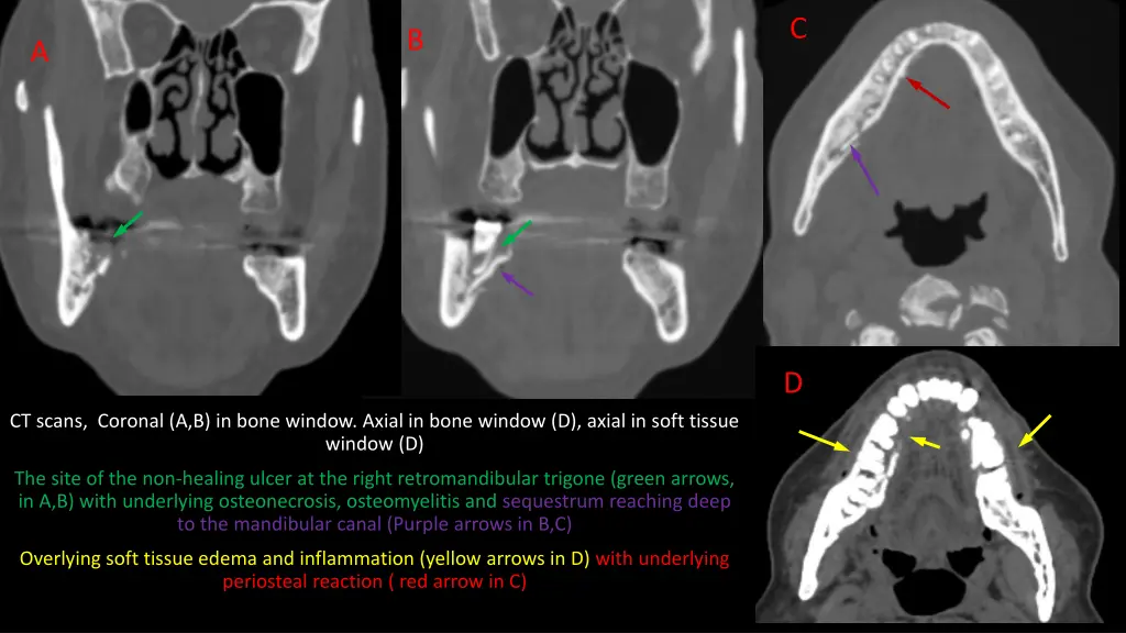 slide3