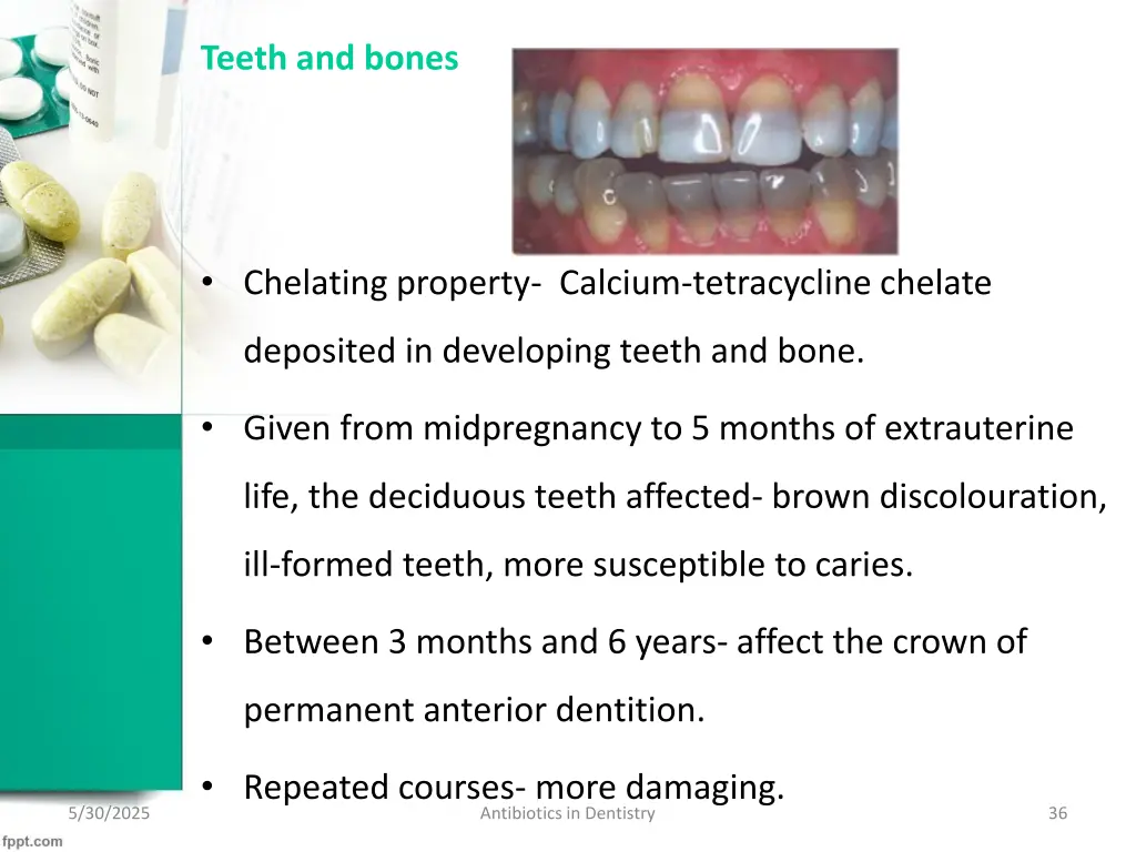 teeth and bones
