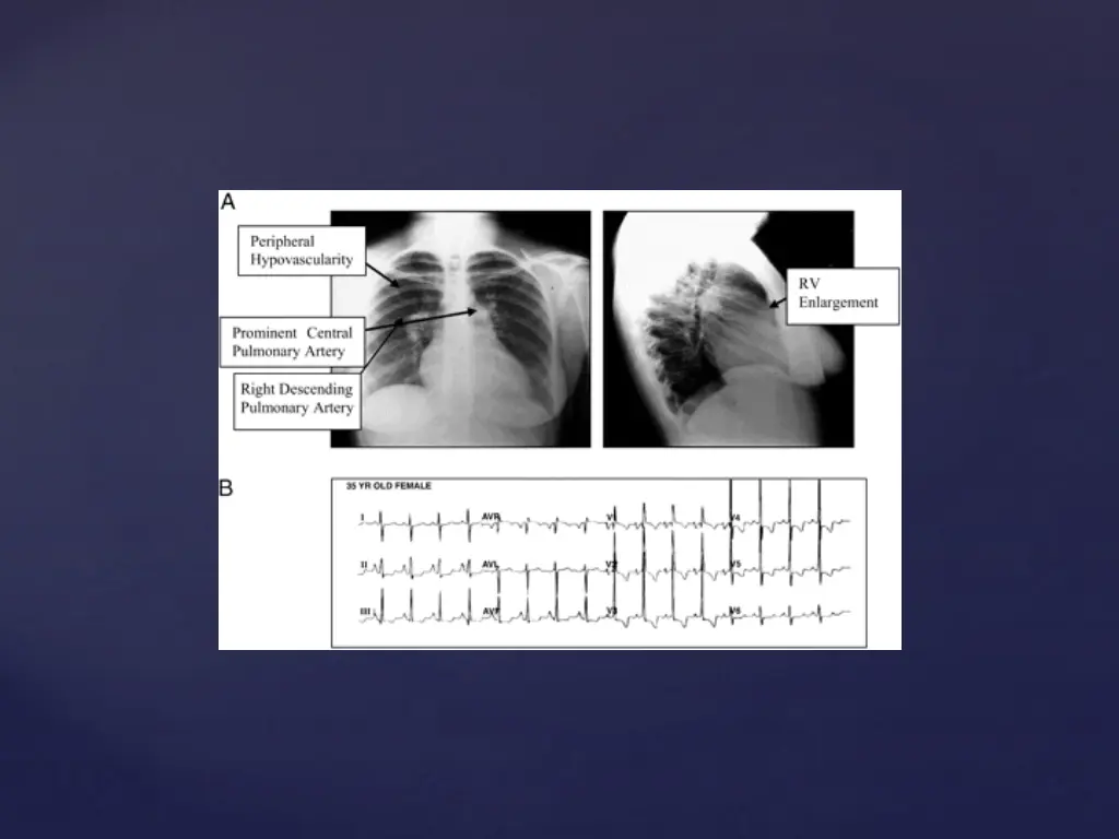 slide10