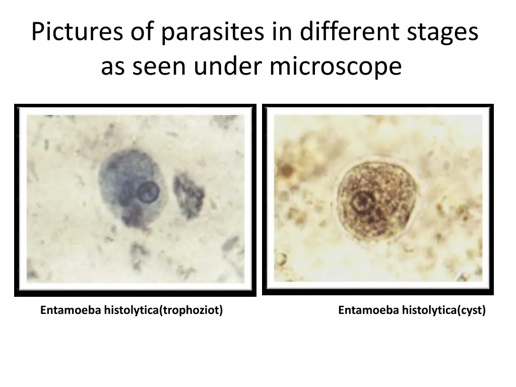 pictures of parasites in different stages as seen