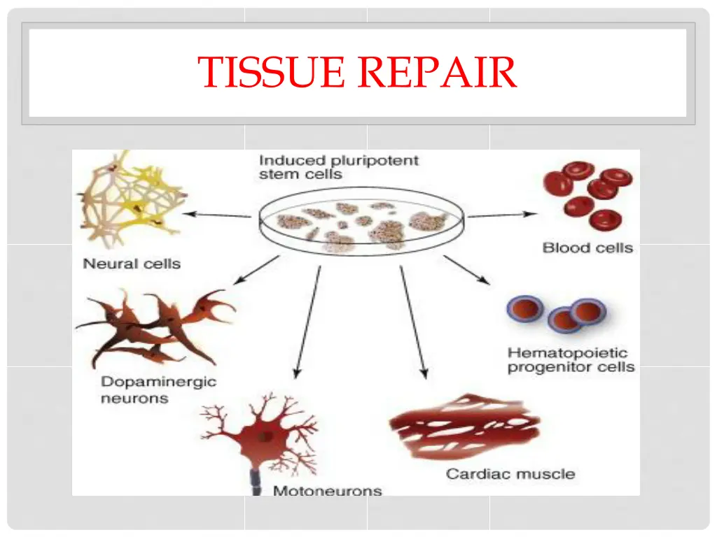 tissue repair