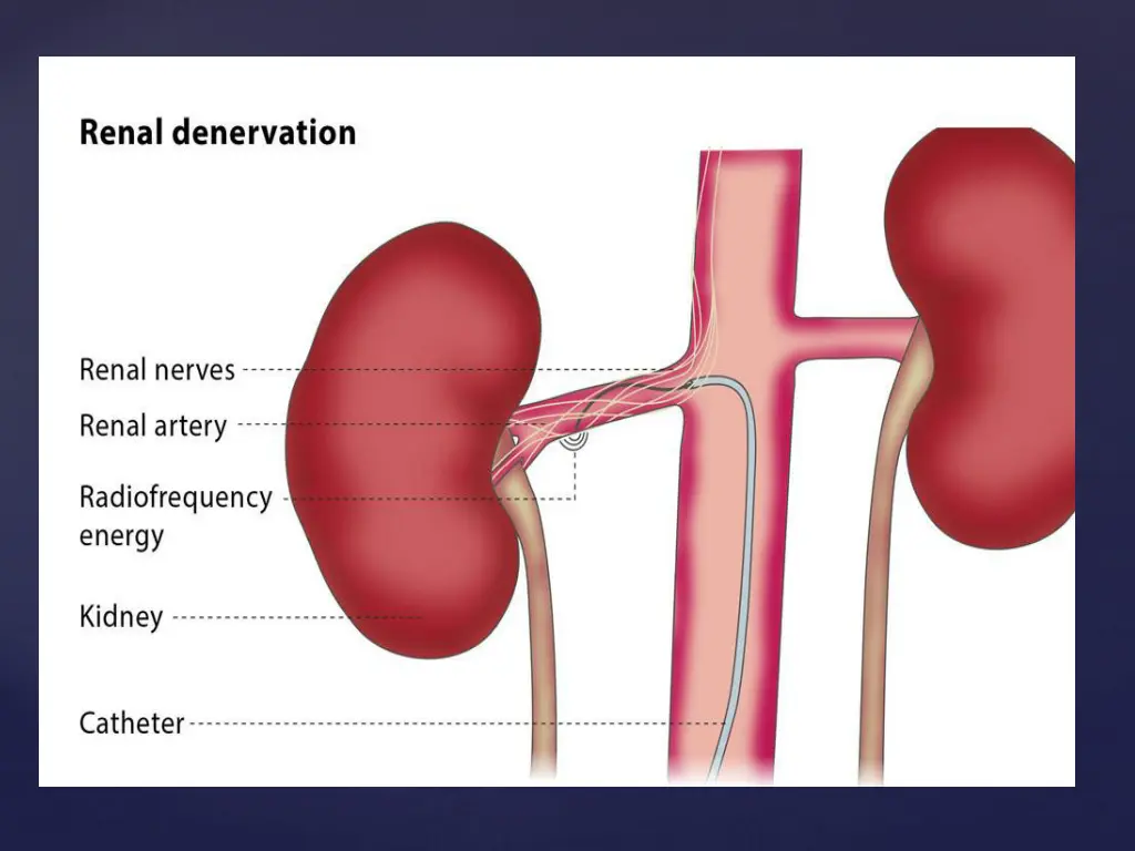 slide33