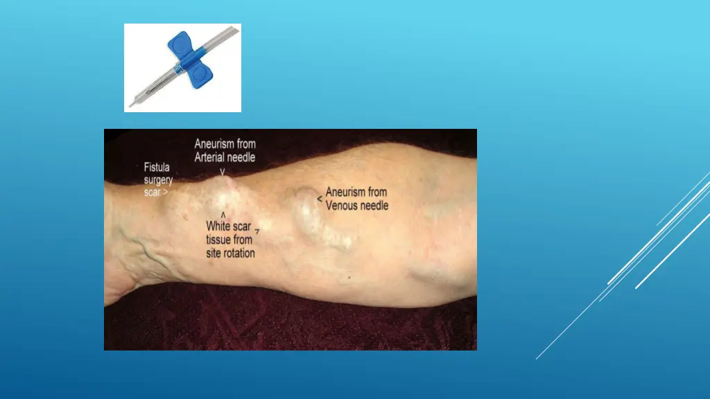 slide5