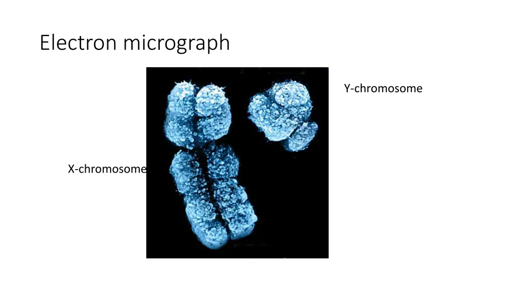 electron micrograph
