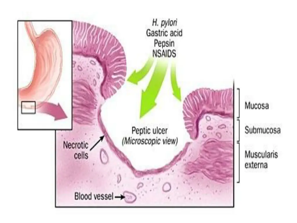 slide5