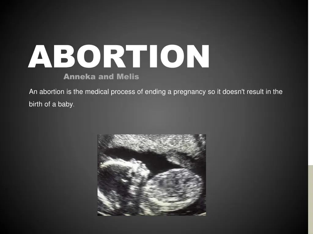 abortion anneka and melis