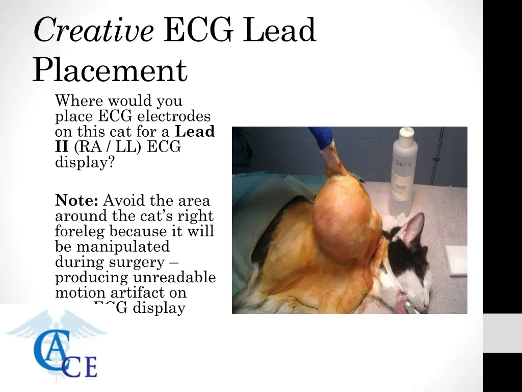 creative ecg lead placement where would you place