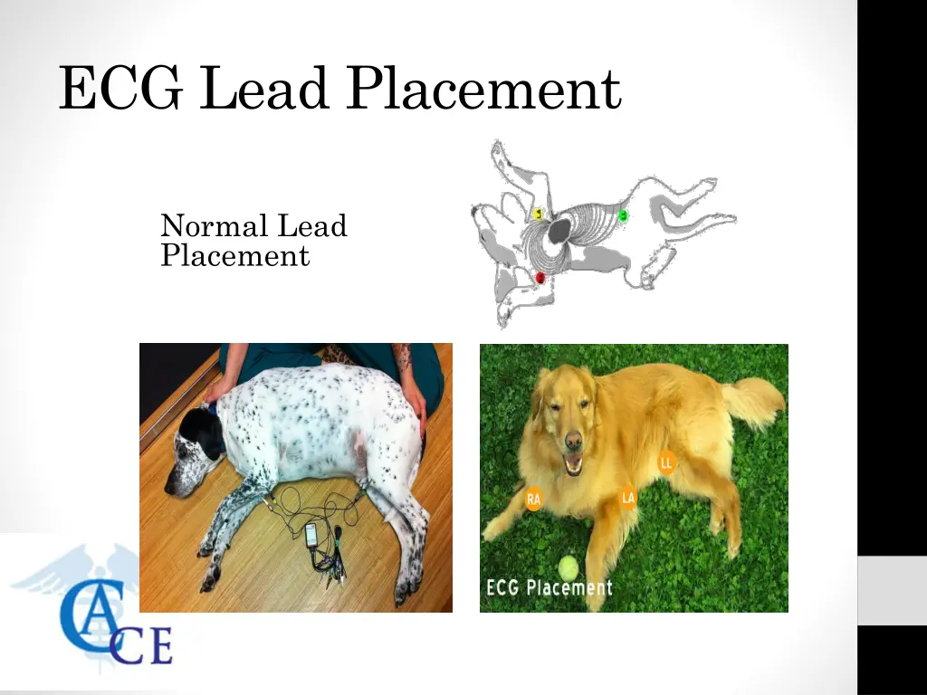 ecg lead placement