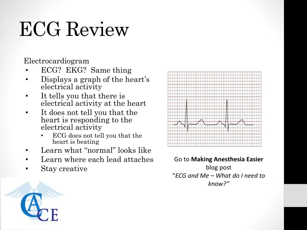 ecg review