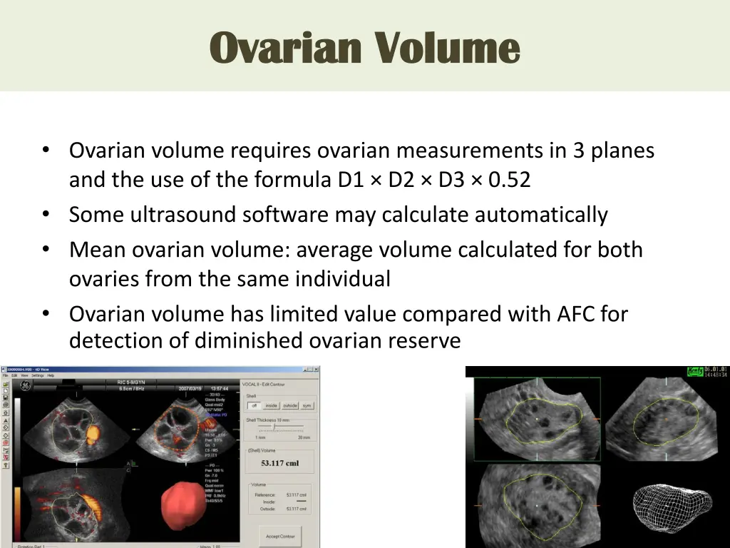 ovarian volume ovarian volume