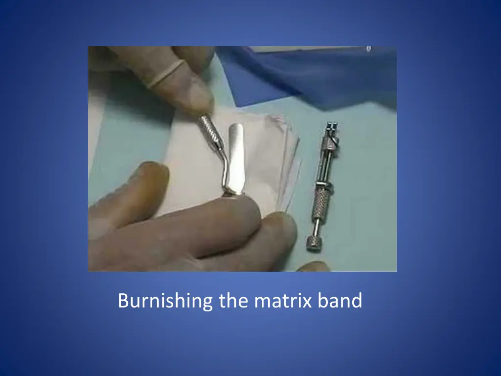 burnishing the matrix band