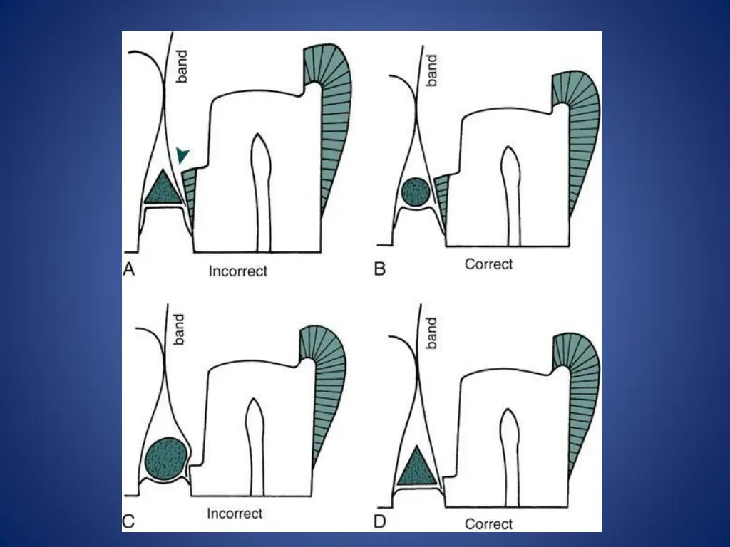 slide23