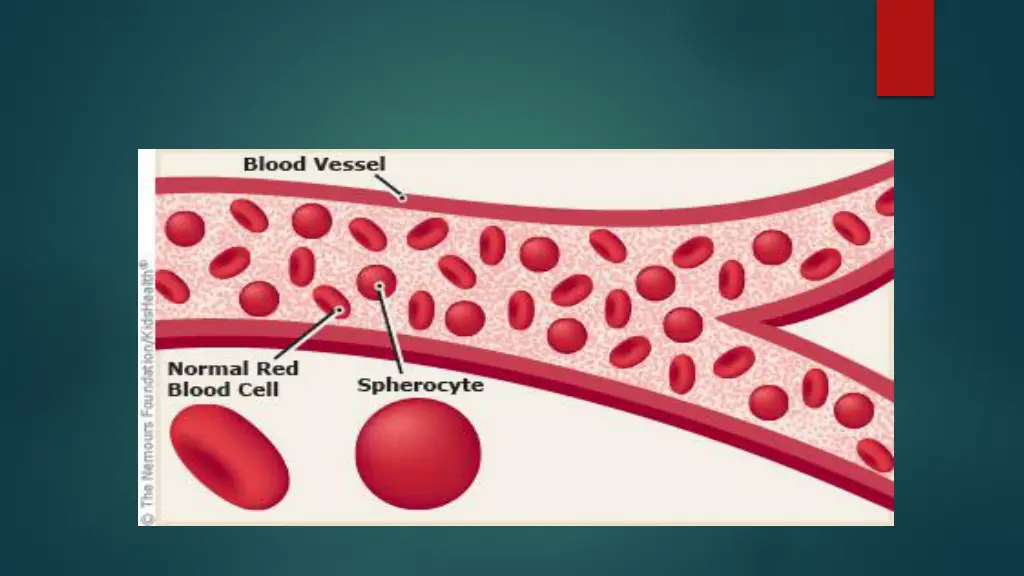slide9