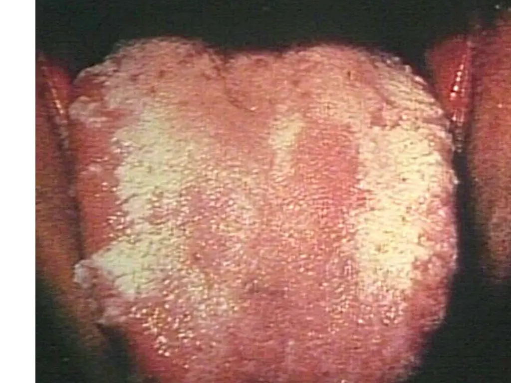 slide20