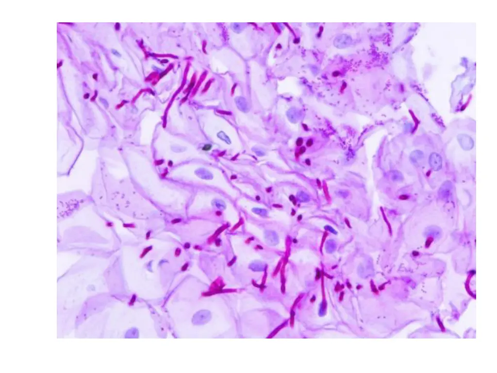 slide23