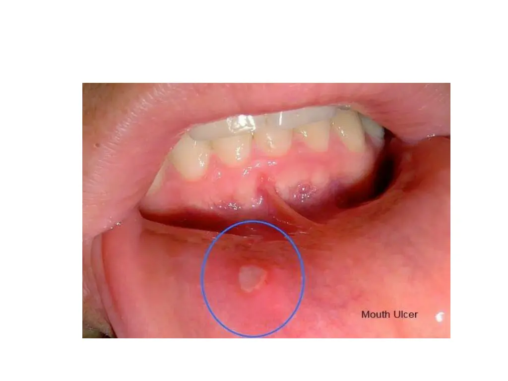 slide5