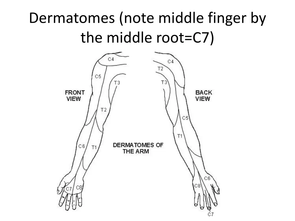 dermatomes note middle finger by the middle root