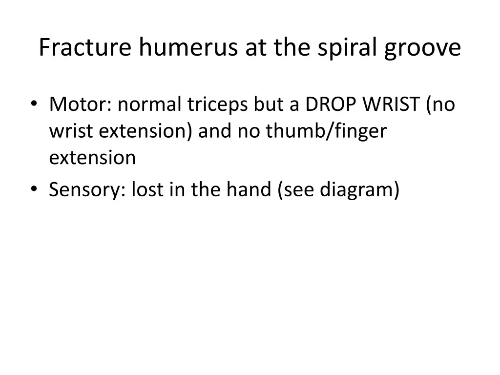 fracture humerus at the spiral groove