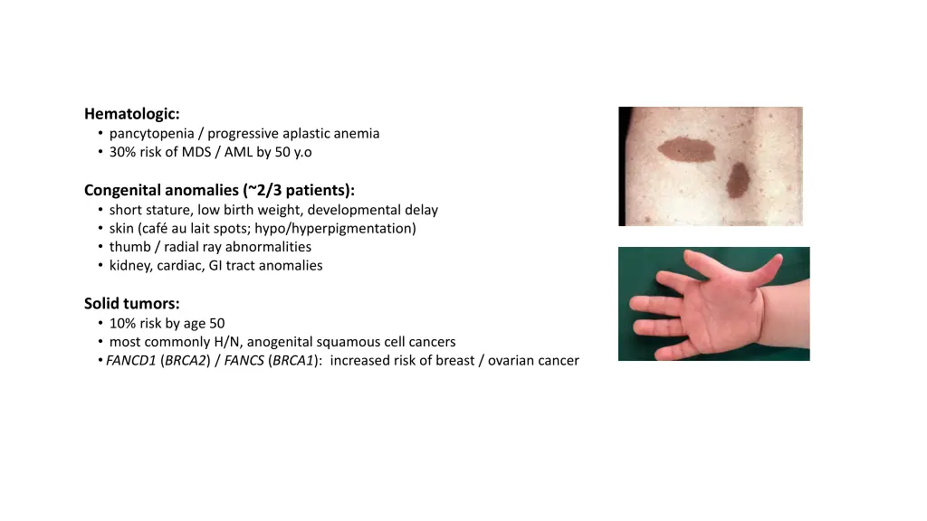 hematologic pancytopenia progressive aplastic