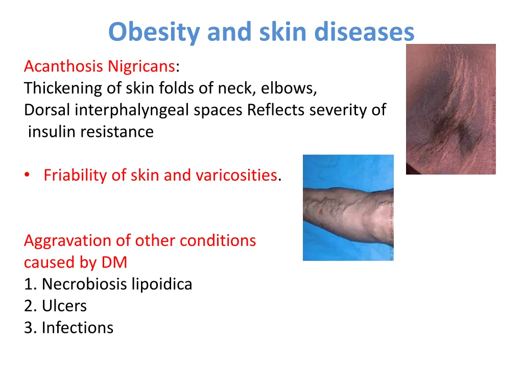 obesity and skin diseases