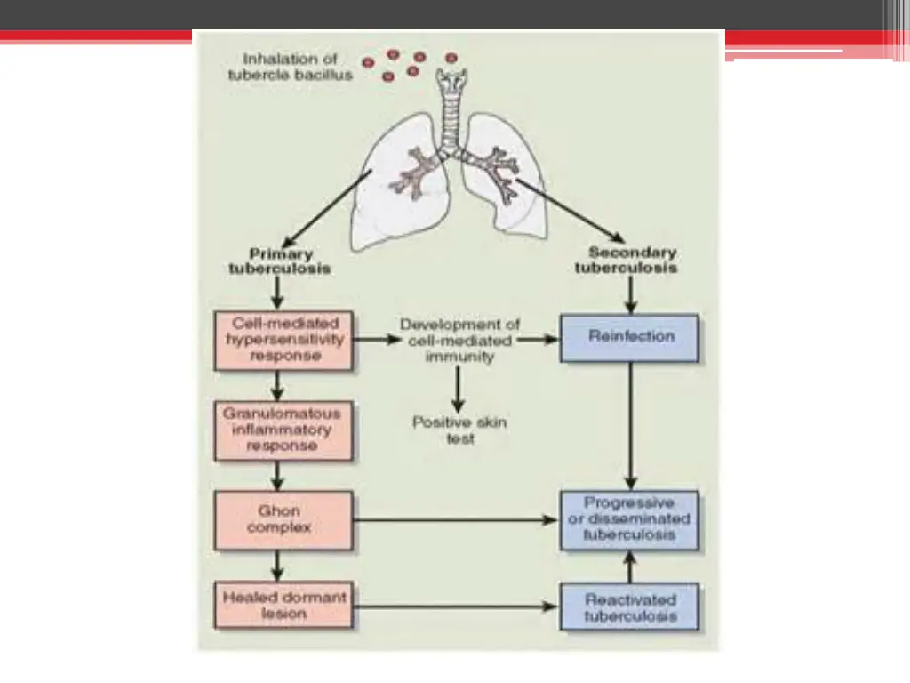 slide14