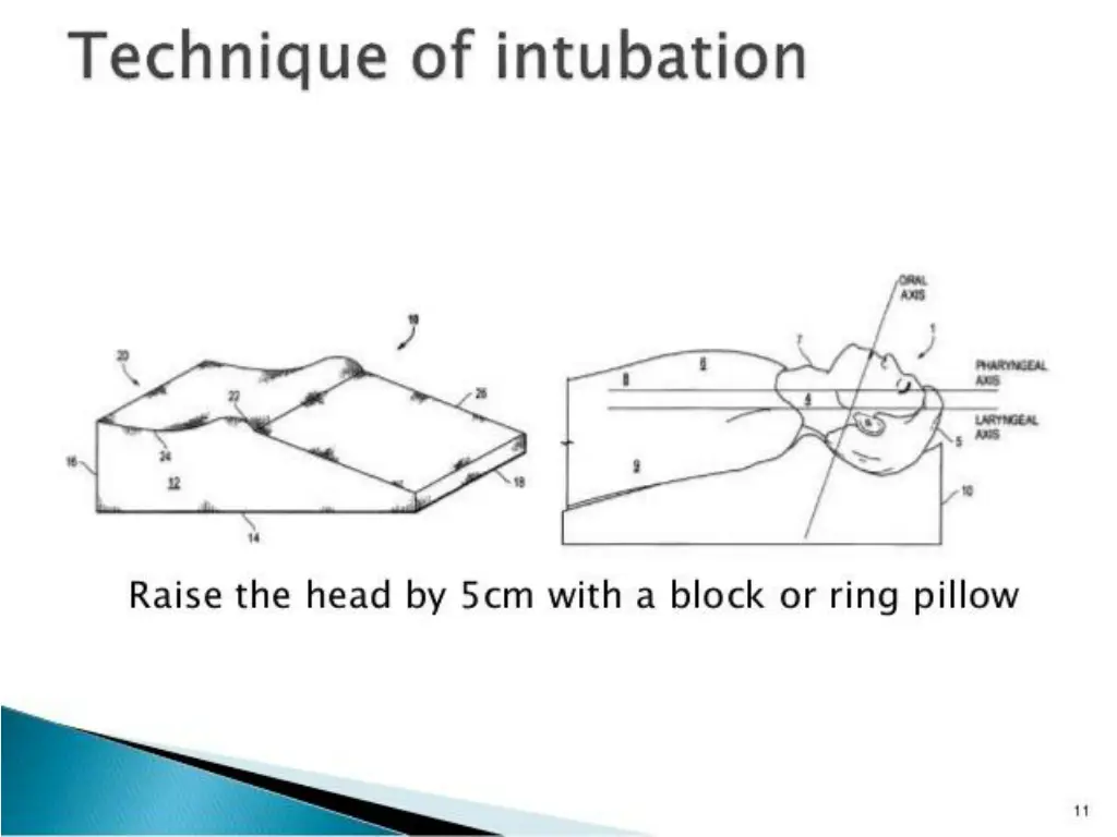 slide10