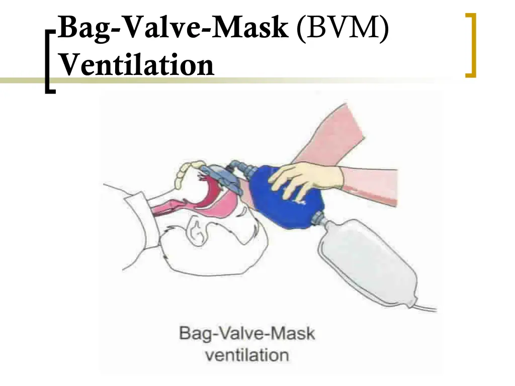 bag valve mask bvm ventilation