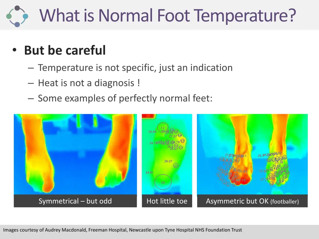 what is normal foot temperature 3