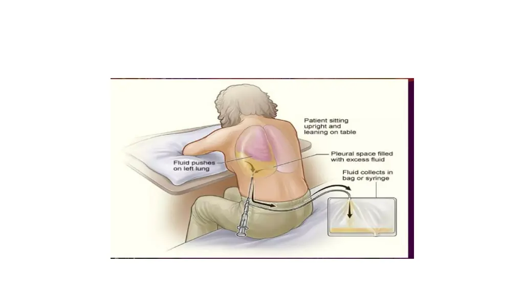 slide5