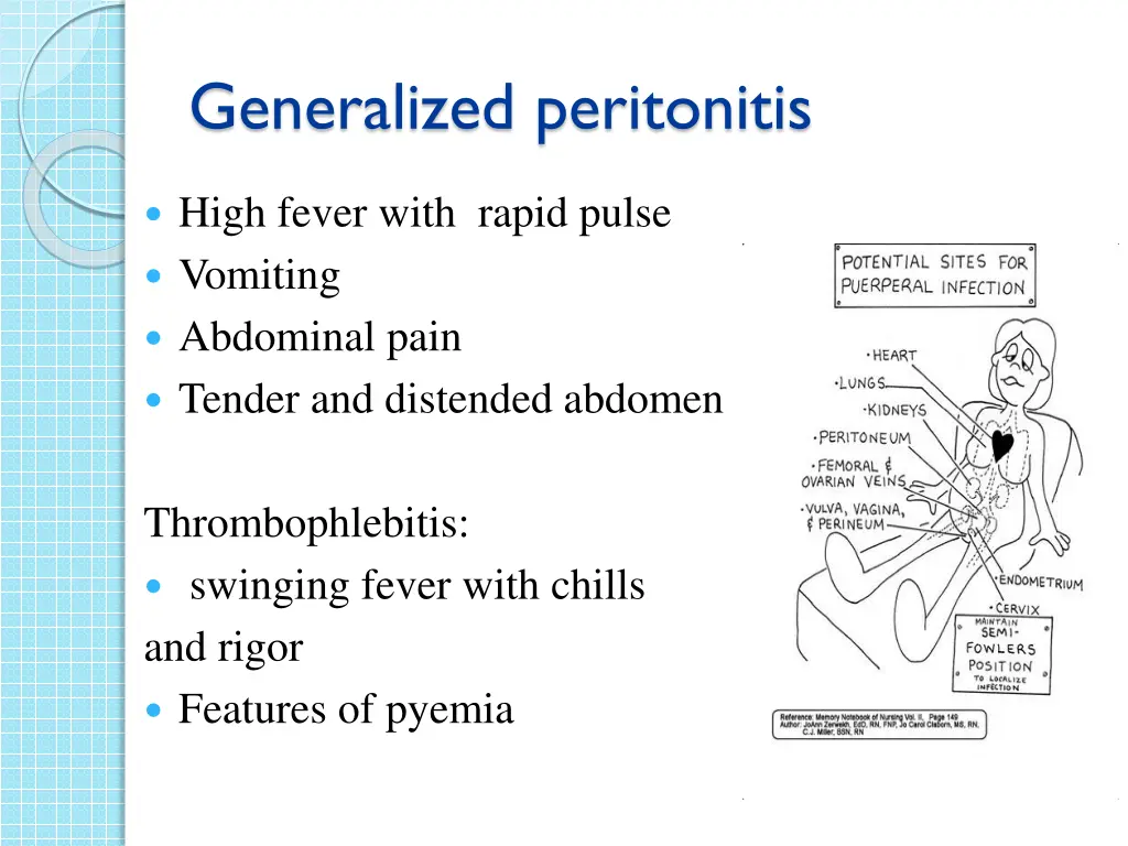 generalized peritonitis