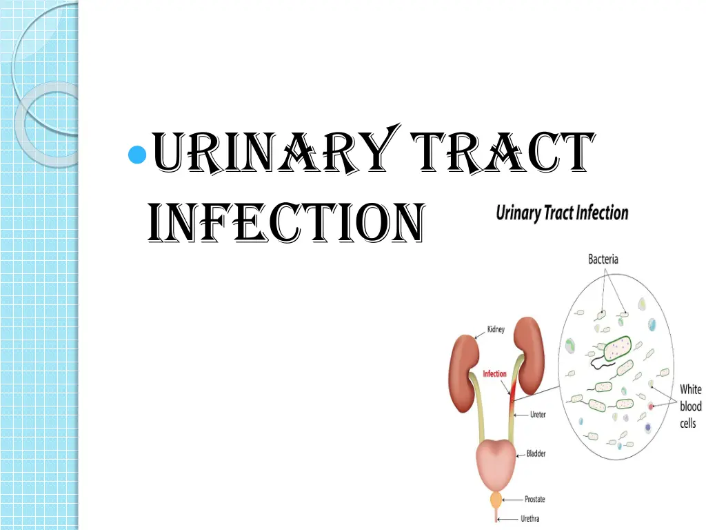 urinary tract infection