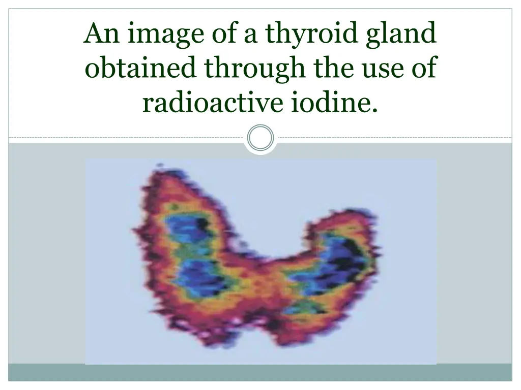 an image of a thyroid gland obtained through