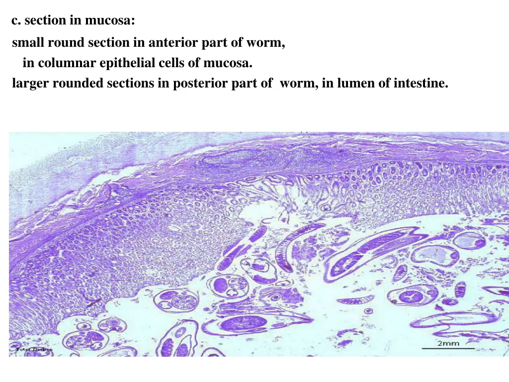 c section in mucosa small round section
