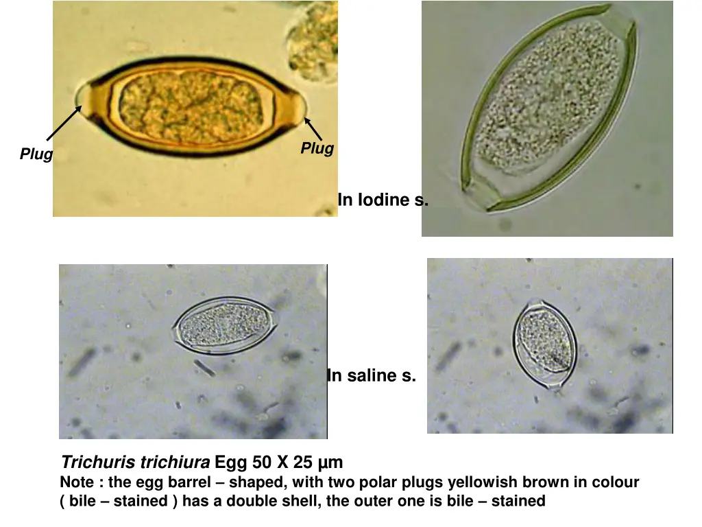 slide11