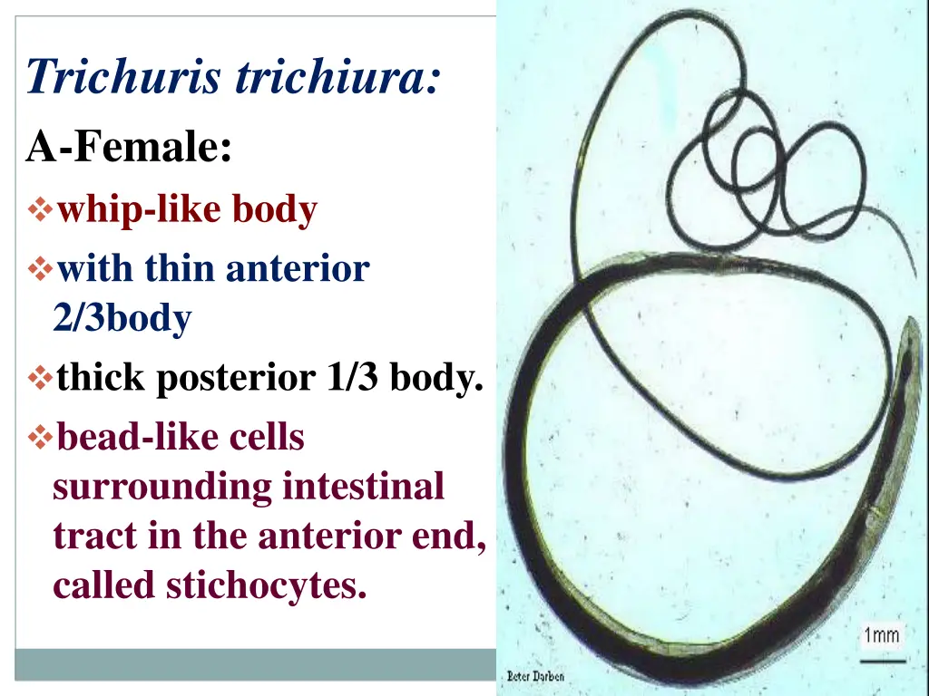 trichuris trichiura a female whip like body with