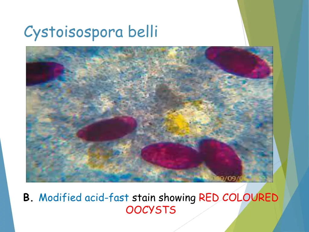 cystoisospora belli 1