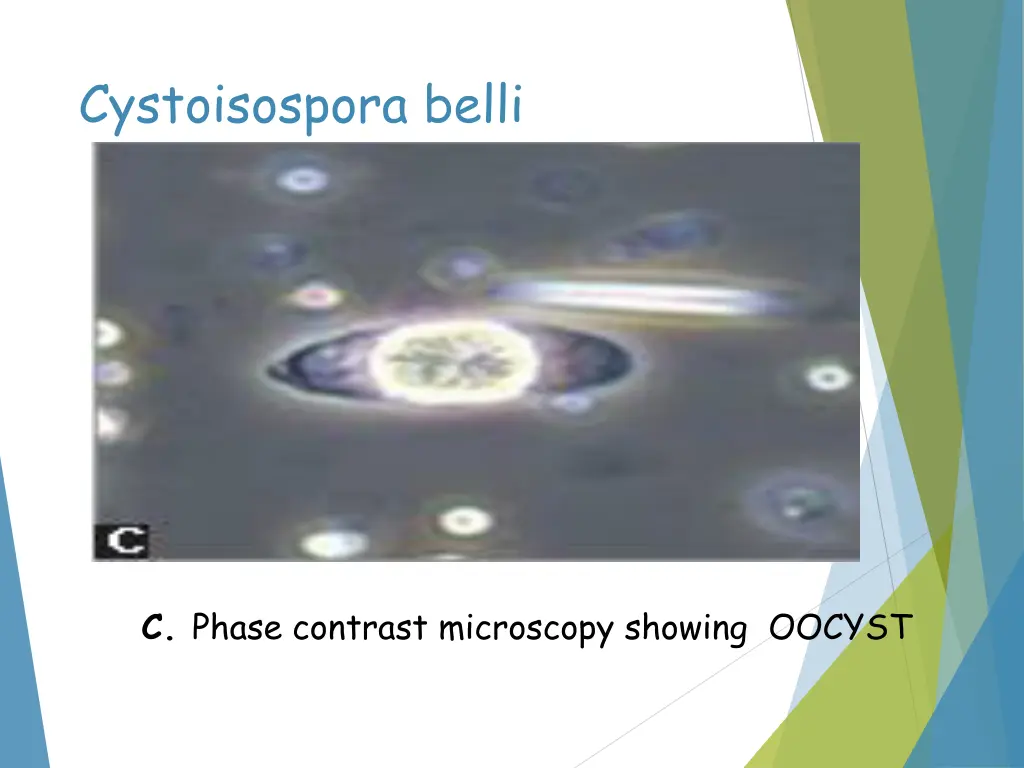 cystoisospora belli 2