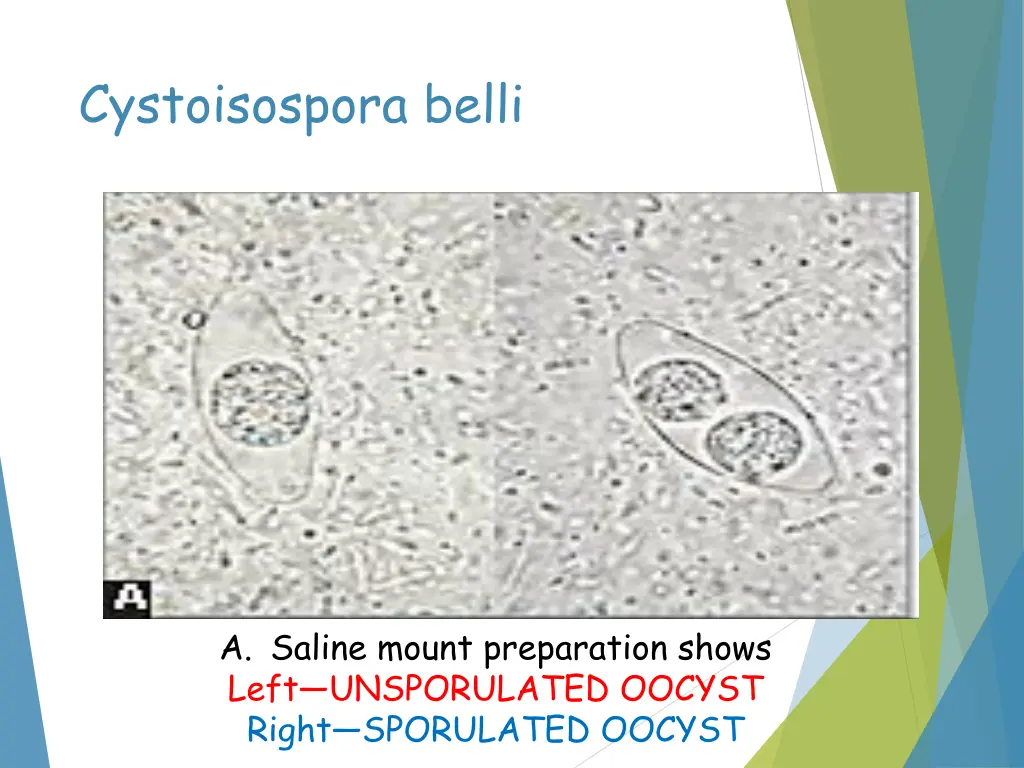 cystoisospora belli
