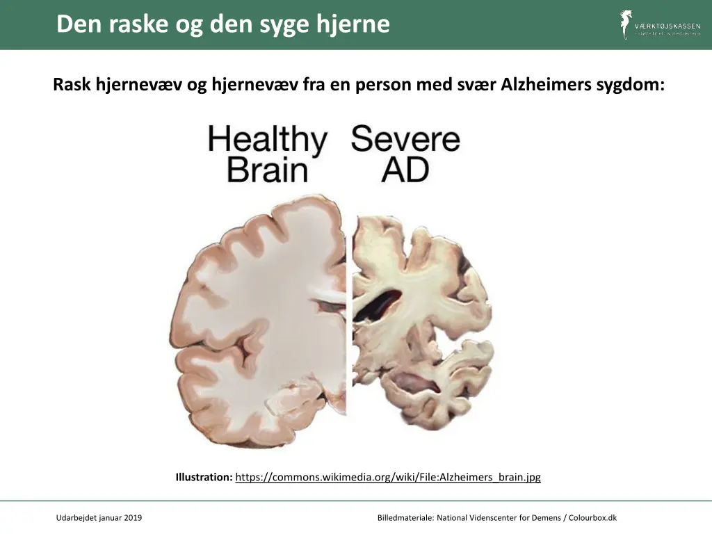 den raske og den syge hjerne